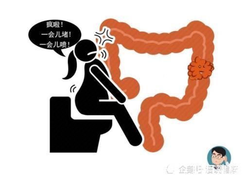 肠癌|常便秘的人若排便伴有2个症状,需当心,这或是肠癌在“搞事情”