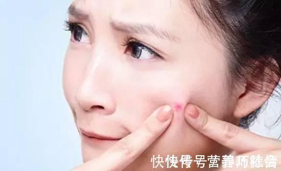 清洁|长痘成女生“心病”,怎样预防长痘?长痘要注意什么?