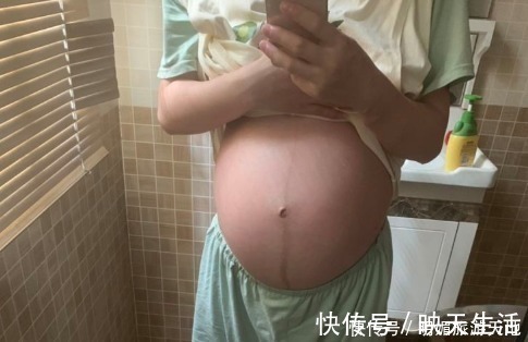 胎儿|四维彩超疏忽准备,准妈妈重复爬楼梯,太粗略了