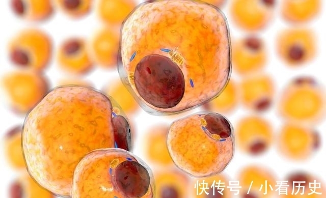 苦瓜|糖尿病如何控制并发症,研究发现:每天吃点这可让血糖慢慢降下去