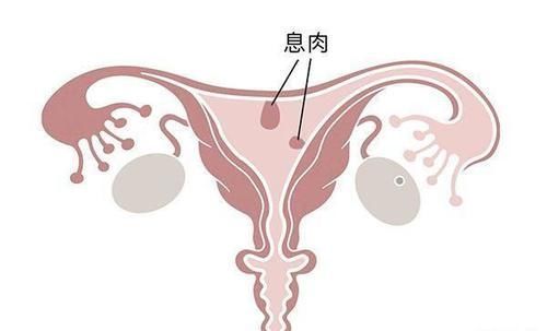 体质|痰湿体质,是怎么回事?有什么妙招,能够帮助调理痰湿?