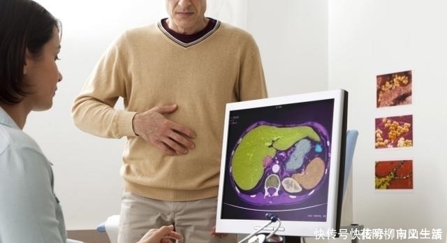 “强肝冠军”不是枸杞,而是它,经常端上餐桌,肝脏悄悄变好了