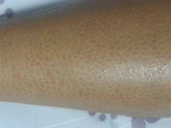 配方|一个化掉全身瘀血的经典配方，一凉一热，让你从头到脚不淤堵