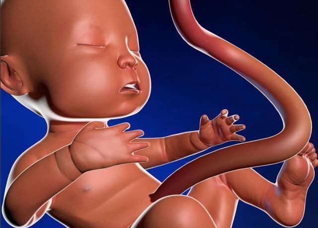 小琳|“脐带绕颈”只是因为胎儿调皮?还有这5件事,也会导致这种结果
