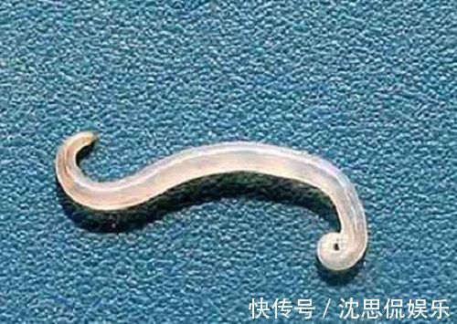 小月|3岁男孩总是“掏裆”，妈妈发现不对劲，检查后才知是“蛲虫病”