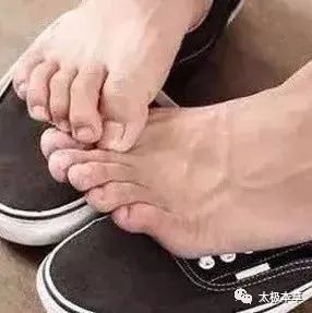 调匀|手脚出现的小毛病,用简易良方,原料易得,收藏吧·