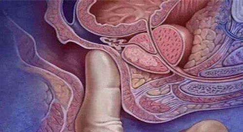 肛检和内检|孕妇们想要顺产,躲不过这项检查,做过的都说很尴尬