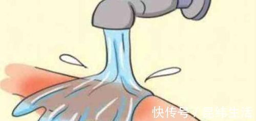 湿润状|孩子烫伤以后,要马上去医院吗?不是,这样会更严重