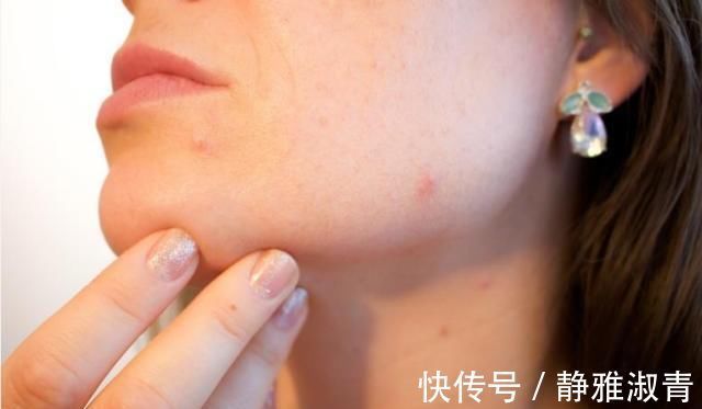 怀孕期间|怀孕后,不仅仅是肚子变大!还有这8种变化,你经历过几种?