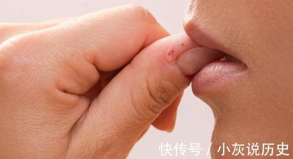 信号|抠手,啃指甲停不下来的背后,可能隐藏着一些心理信号