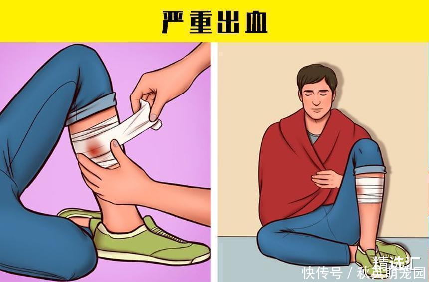 毒蘑菇|在紧急情况下，或许可以拯救生命的7个小技巧