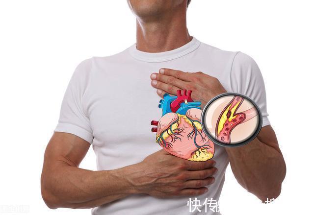 舒张压|老年高血压患者压差越大，心脑风险越大，如何降低？首选3类药物