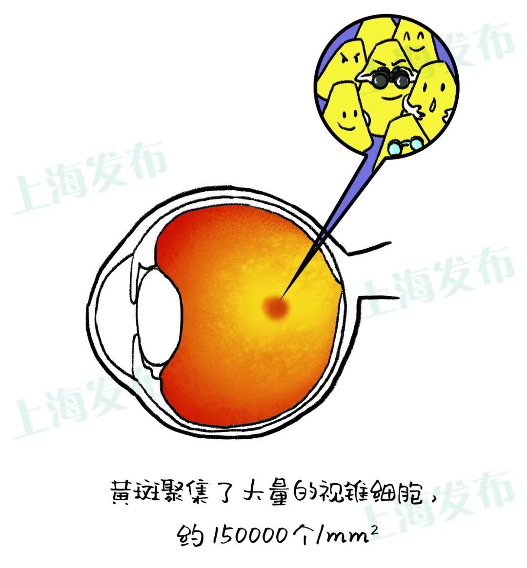 视力就是黄斑的能力，病变了很麻烦