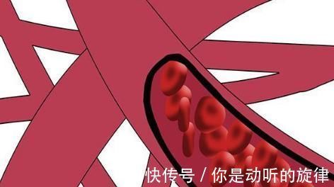 疼痛|其实，人上年纪最怕身体3处疼，出现了，血管多半已经“堵”了