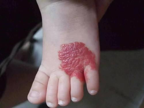 色素|孕期这些行为,会给你的孩子带来“印记”,孕妈可别忽视