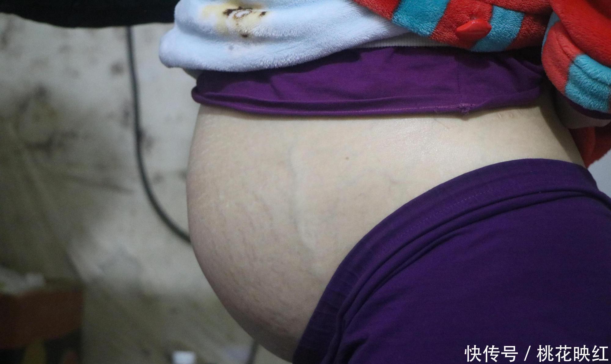 肚皮|孕妇的肚皮到底有多薄为了肚皮的安全，3件事要少做！