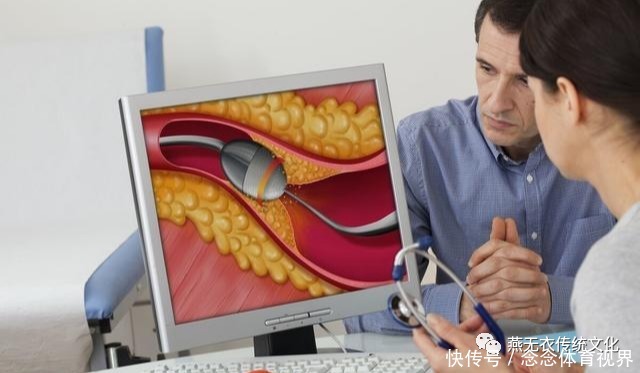 50岁男子，甘油三酯从6.8降到1.7，经验就是坚持吃了1物