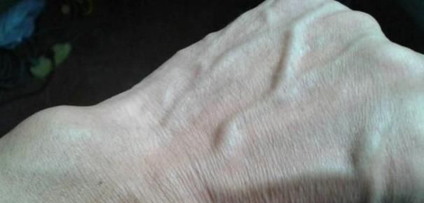 如果手上有3个“表现”,那就祝贺你了!肝脏是人体的主要器官!