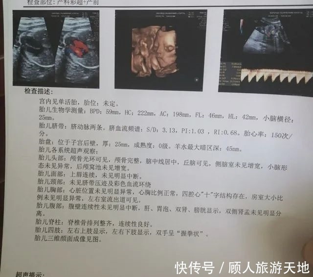 胎儿|四维彩超单上的三个数据，暗示胎儿发育好不好，孕妈学会看更省心