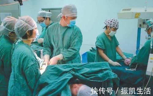 孕期|产检时,医生会问“头胎还是二胎”,这里面的小九九可要知道