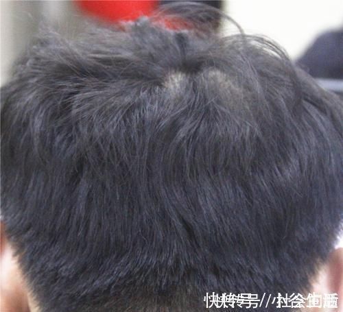 身体衰老|男人开始变老，身体会很“诚实”，如果状况百出，要服老了