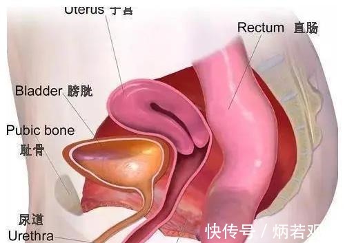 压力性|产后这些「羞耻」的后遗症，折磨了无数宝妈！3招就能解决