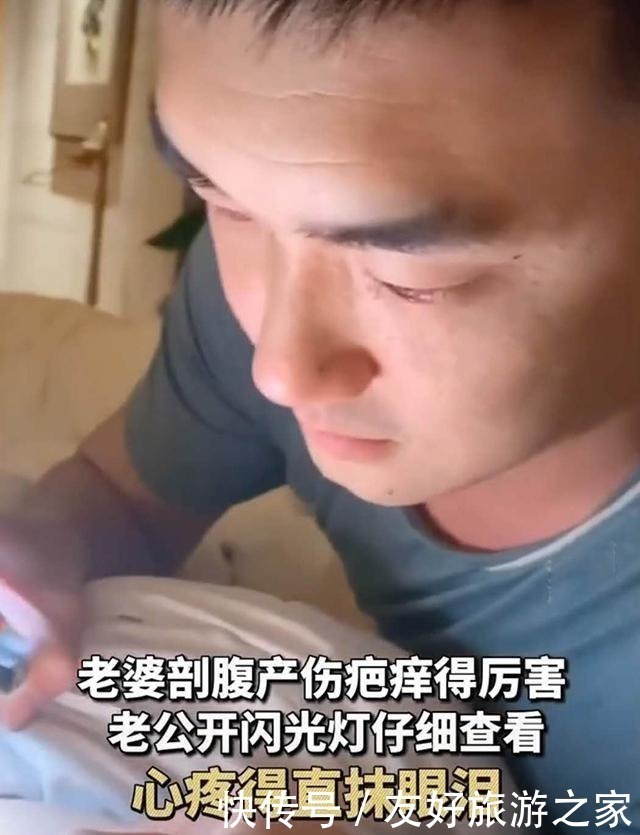 剖腹产|阴雨天,宝妈剖腹产伤疤痒得厉害,老公表现太暖心,网友嫁对了