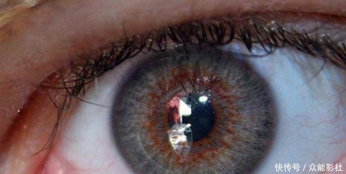 阿根廷一男子因痴迷于童话人物,竟花费240万整形成“精灵”