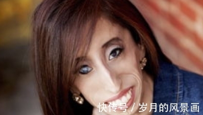 纪录|曾破吉尼斯最瘦纪录的骷髅女孩,只有27公斤,如今成励志女孩