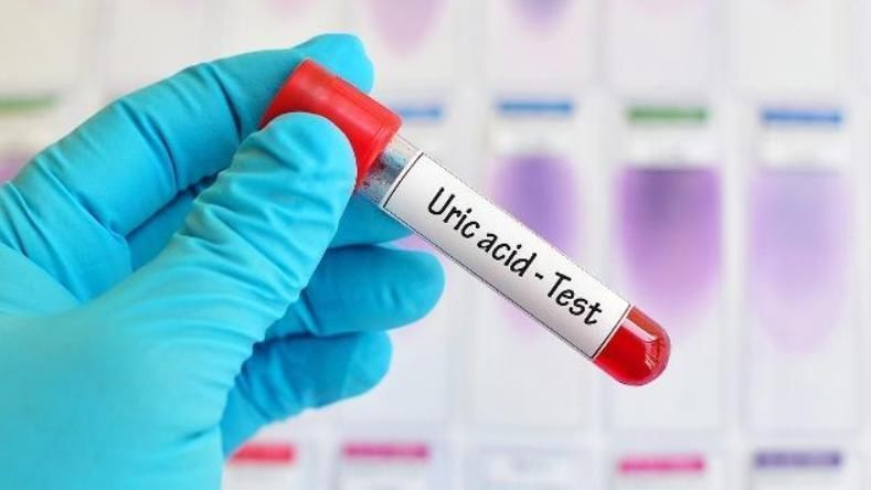 偏高|尿酸高的人,2种食物再馋要忍住,多吃3物,降尿酸,痛风绕道走