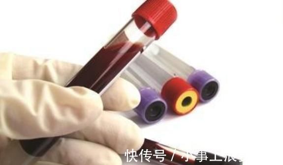 凝血因子|长期服用阿司匹林的人，如果三种情况出现时，要引起重视暂停服用