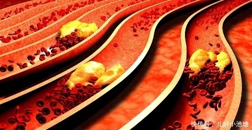 紫菜|血管最怕堵,让你花2块钱不到,只需一碗汤,给血管“洗个澡”!