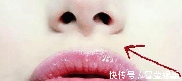 豆制品|女人患有妇科病,脸部会出现这3个暗号,发现1个就最好去查一查