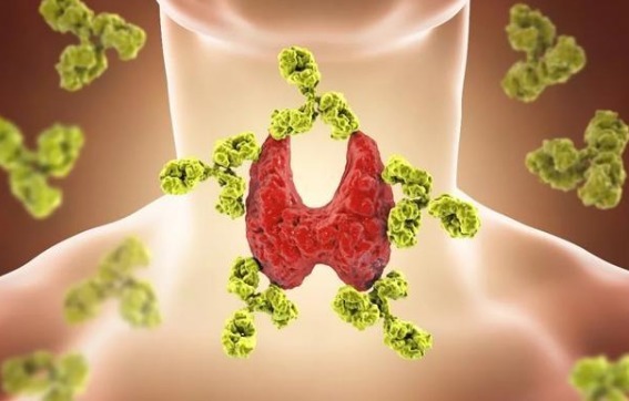 检查|一家五姐妹全部得癌症,一检查还是晚期!医生惋惜,有些钱不能省