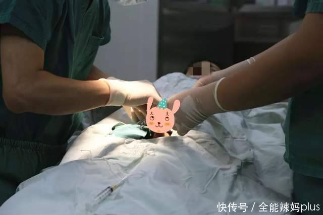 包皮手术