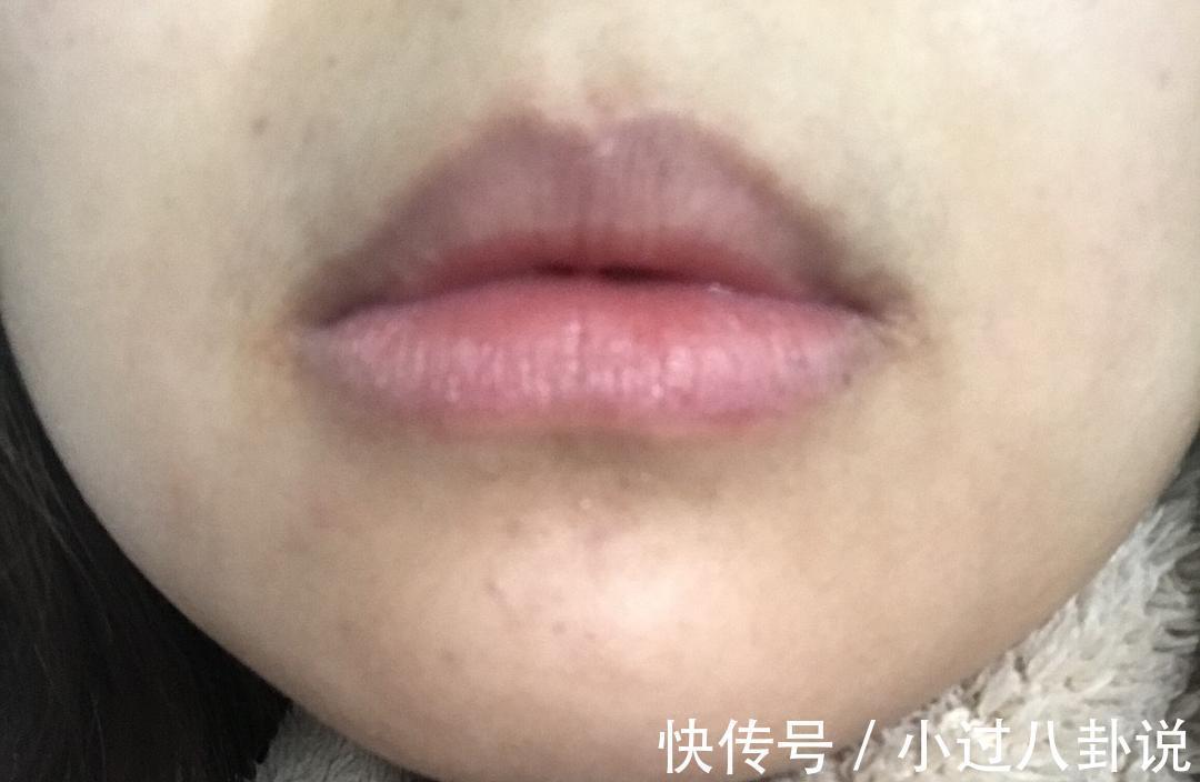 内分泌失调|女性子宫好不好看“脸”便知,如果没这些症状,说明子宫很干净