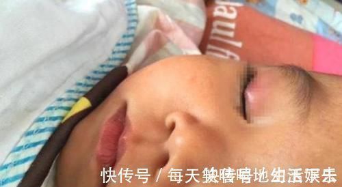 胶水|4岁儿子误将502滴进眼睛,妈妈一个举动挽救孩子,医生:睿智