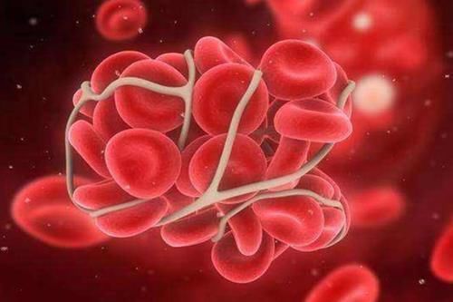 血脂|吃一口等于5斤芹菜,医生呼吁:血液粘稠常吃,清血管降血脂,血管会更好