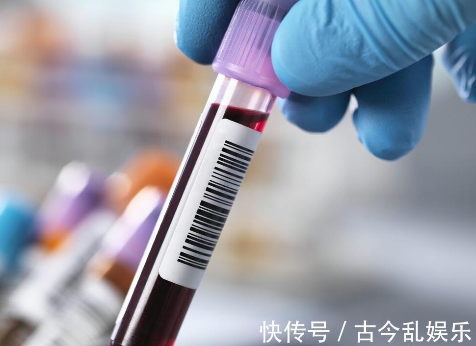 血管|108岁老人，气色年轻像50岁，长寿秘诀不是多走路，而是这3件事