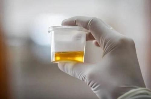 2021年最新高嘌呤食物名單公布，雞精排第3，榜首多半人在吃