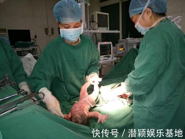 产妇|生孩子顺带解决了“生理需求”，产妇一脸尴尬，医生却说这是好事