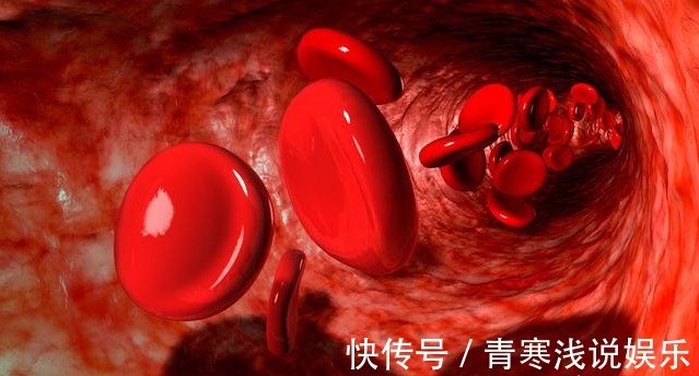 冠心病|血脂高不高，看头就懂，若没有出现这3大症状，你就知足吧