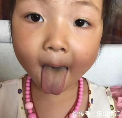 积食|孩子脾虚“元凶”被揪出,医生提醒:这3种水果少给娃吃,伤脾胃