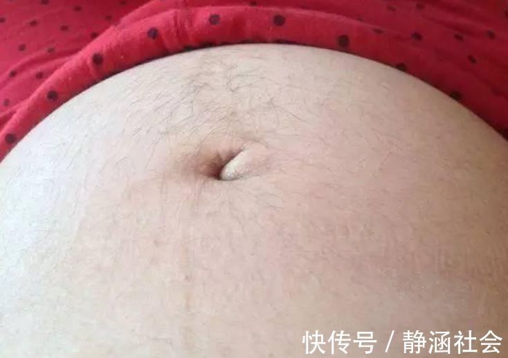 肚子|准妈妈肚皮被“盯上了”，孕肚的几个特点，跟胎宝性别有关吗？