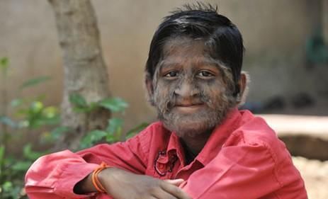 体毛|有的女性体毛旺盛，有的却“光秃秃”，你知道其中原因吗？