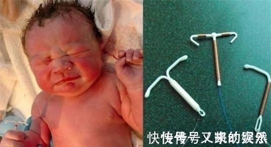 医生|宝宝出生,自带武器,医生凑近一看,大吃一惊