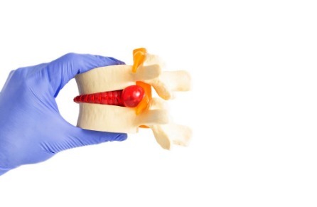 马尾|马尾神经损伤一定要早治疗