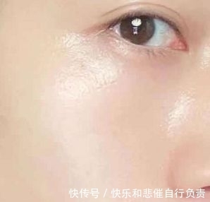 椰油酰甘氨酸钠|没想到皮肤经常出油的原因竟是这个!你中招了吗?