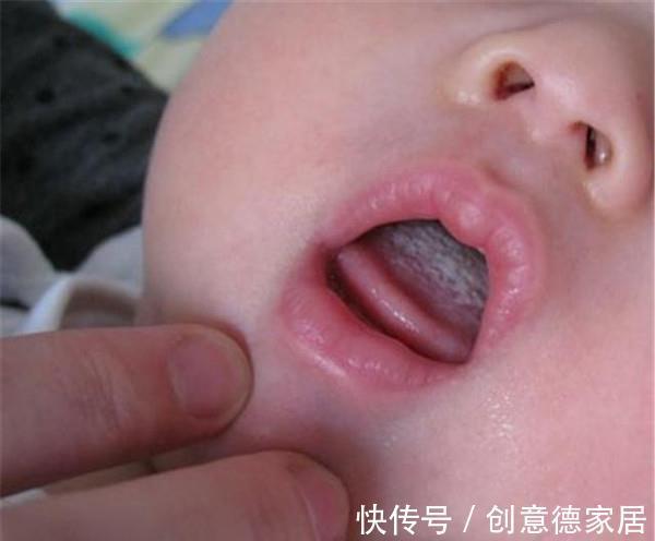 孩子|入秋后的“长高王”,医生:吃一口相当于喝5瓶奶,孩子不妨多吃