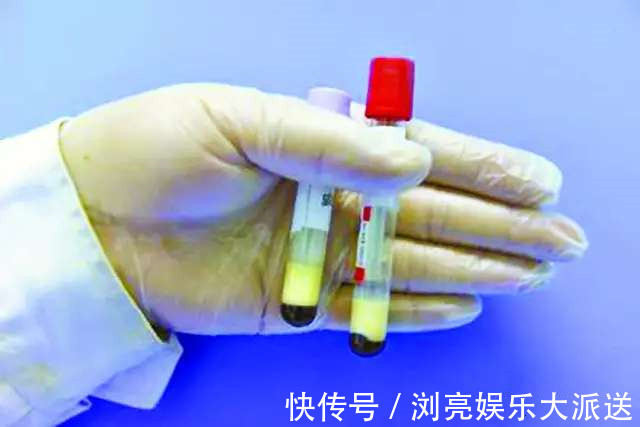 急性胰腺炎|甘油三脂3-5算是严重超标吗吃什么可以降下来医生说清楚